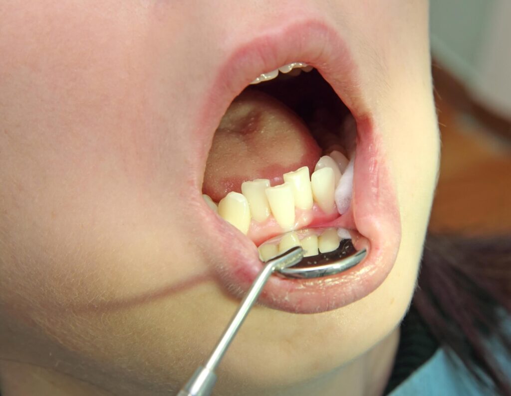 an Orthodontist in Pearl City examining a child's lower teeth