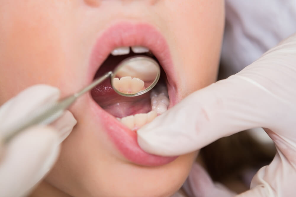 Emergency dentist in pearl city with a thorough regimen and check up.