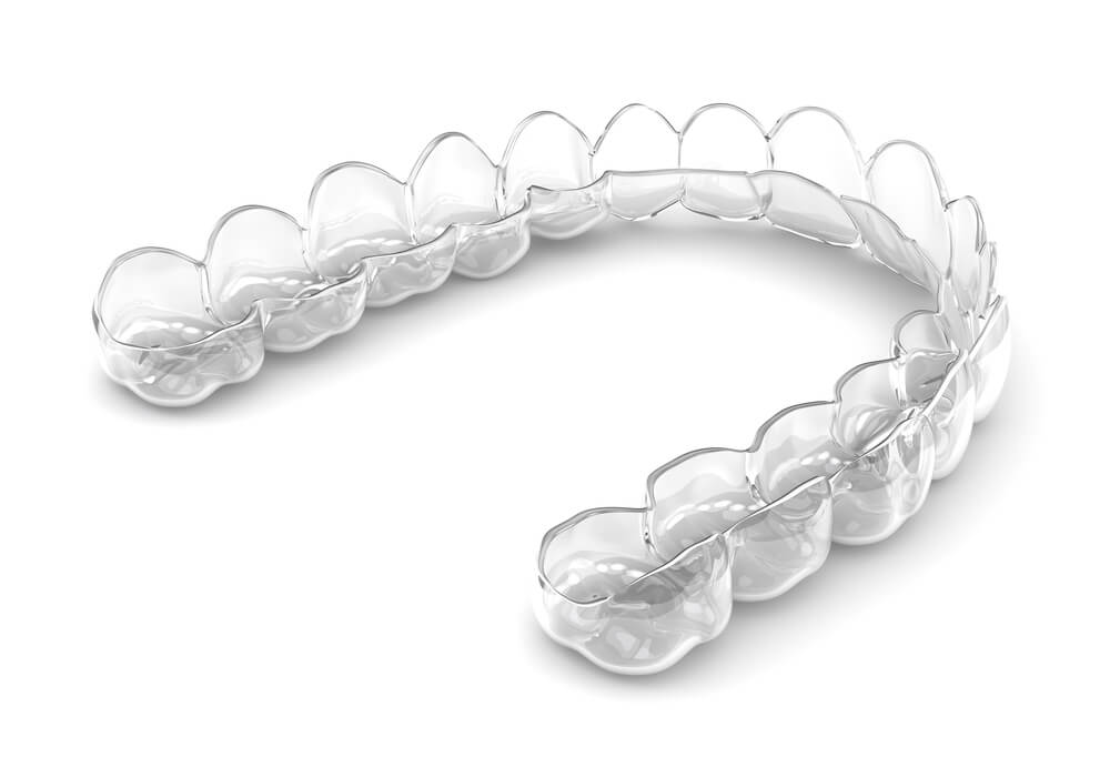 A sample of Invisalign in Kapolei