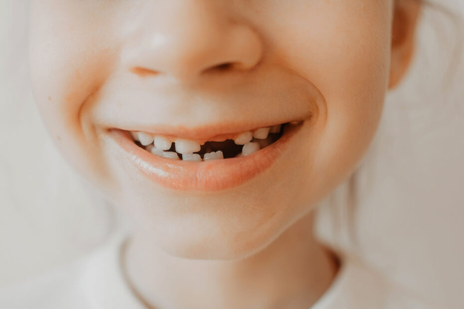 Emergency Dentist in Kapolei for Tooth Loss