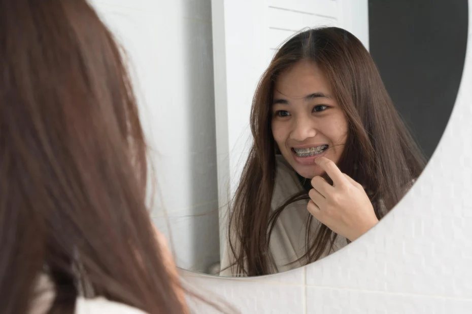 Pediatric Orthodontic in Lihue Explains Why the One-Year Mark Can Be Harm for Kids with Braces